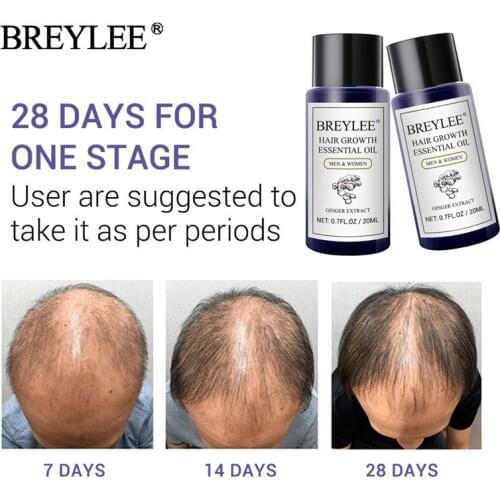 BREYLEE 2PCS Hair Growth Essential Oil Fast Powerful Hair Products Hair Care Prevent Baldness Anti-Hair Loss Serum Increase Hair