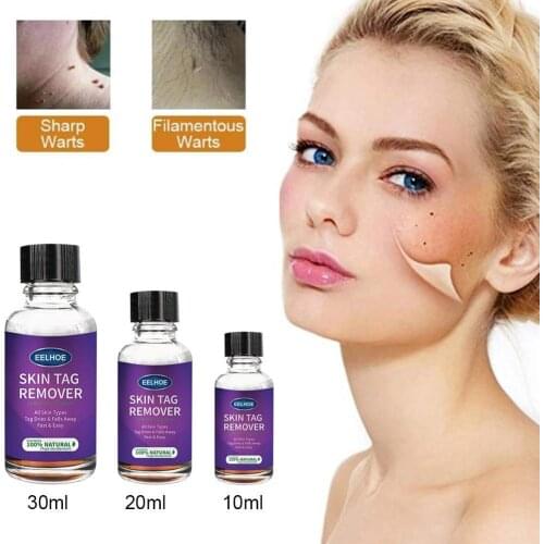 Remover Warts Removal Relief Medical Treatment Meat Corn Skin Flat Wart Antibacterial Liquid Foot Calluses Skin Care Cream