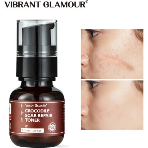 VIBRANT GLAMOUR Removal Scar Serum Remove Acne Pimples Stretch Marks Face Gel Smoothing Whitening Moisturizing Body Skin Care