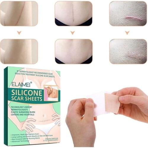 4 Stickers Beauty Scar Stickers Removal Patch Acne Patch Scar Skin Gel Sheet Burn Therapy Silicon Repair Trauma Remove J9Z8