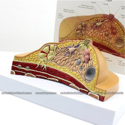CMAM/12461 Pathological Breast, Genitourinary Medical Teaching Anatomical Model