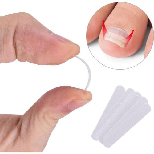 Ingrown Toe Nail Correction Sticker Patch Paronychia Corrector Pedicure Tools Elastic Patches Foot Care Straightener Treatment