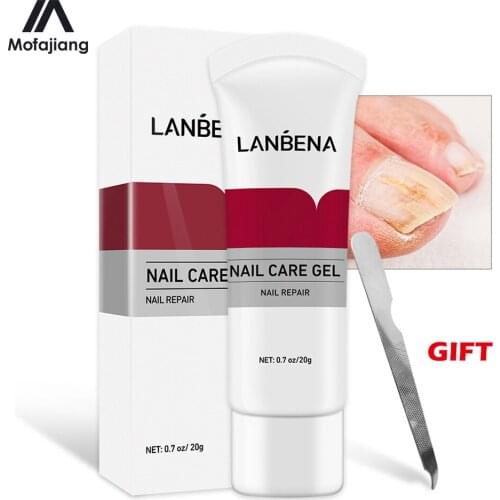 Nail Fungus Removal Cream Onychomycosis Fungal Nail Treatment Paronychia Anti Infection Feet Toe Fungal Nail Care Gel Gift Files