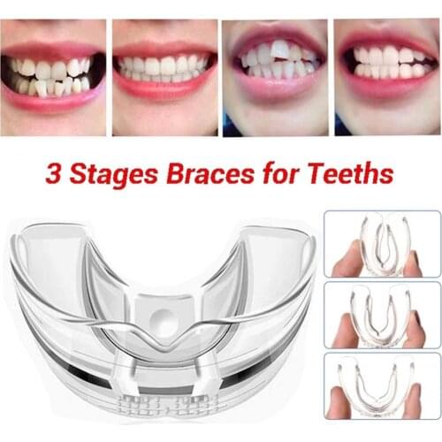 LEKGAVD Products For Teeth Whitening