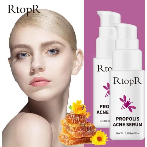 2pcs RtopR Propolis Oil Control Acne Serum Repair Acne Scar Cleansing Serum Shrinkage Elimination Acne Treatment Moisturizing