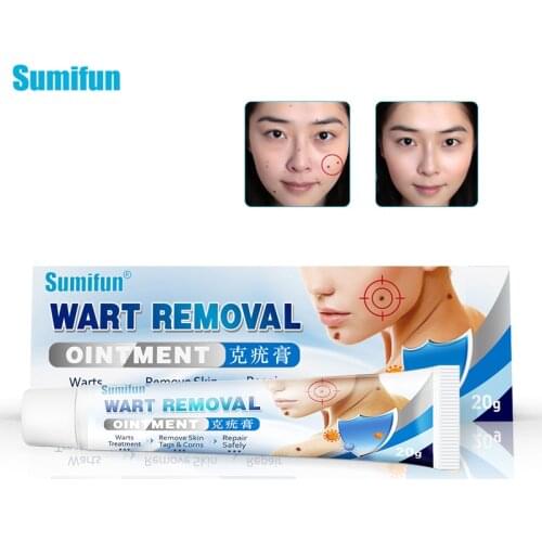 Sumiun 1box Wart Treatment Papillomas Removal of Warts Cream Skin Tags Removing Against Moles Remover Anti Verruca Remedy Cream