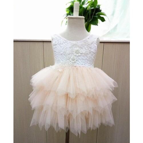 Wechildhood Dresses For Girls
