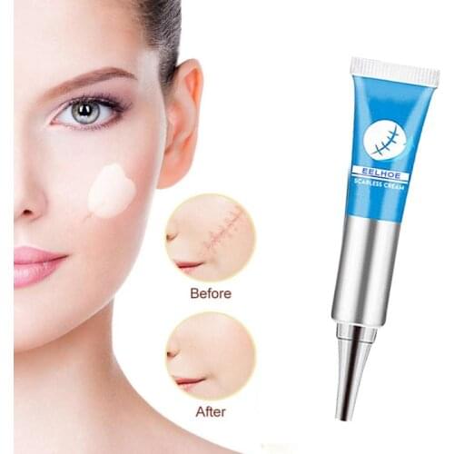15g Scar Removal Cream Face Acne Spots Pigmentation Corrector Whitening Cream Anti Scar Stretch Marks Repair Skin Care TSLM1