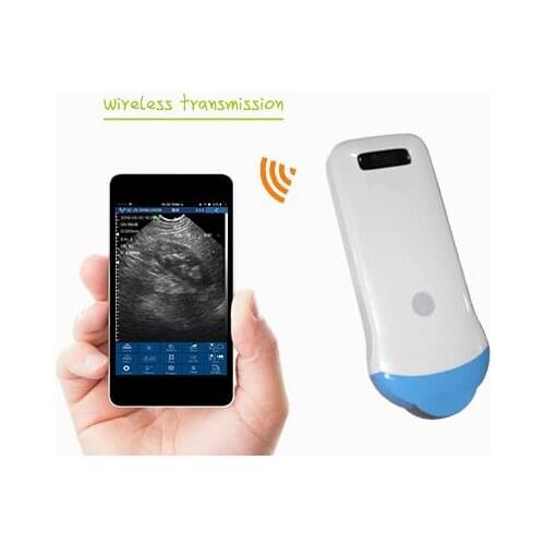 Wireless blue head ultrasound micro convex array probe Uprobe with Reverse harmonic function microconvex