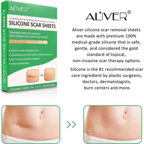 4PCS Reusable Silicone Scar Gel Away Strips Self-adhesive Scar Repair StickerSilicon Patch Remove Trauma Burn Sheet Skin Repair
