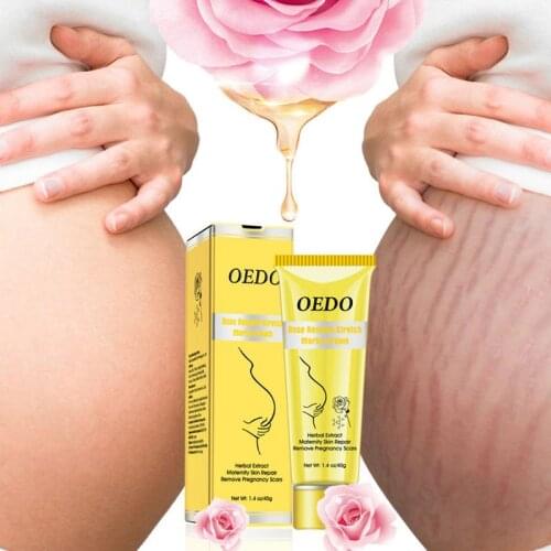 Stretch Marks Cream Anti Wrinkle Anti Aging Maternity Skin Repair Remove Pregnancy Scars Treatment Body Skin Care