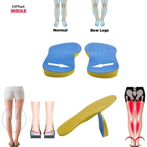 EXPfoot PU Cotton Unisex Knockknees Valgus Varus Corrector Orthotic Insoles Comfortable Breathable Massaging Foot Pads Inserts
