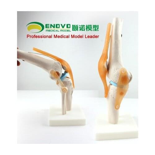 KeyWord: orthopedic teaching; knee model; knee ligament model
