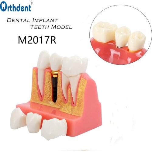 Стоматологические материалы CNSEATO China At AliExpress