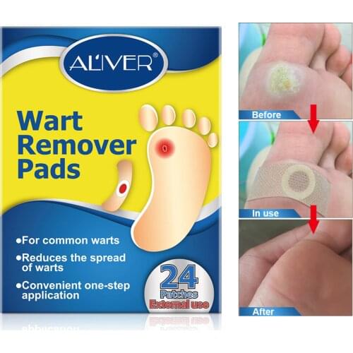 Eyelet stickers Eyelet cream foot paste painless remove feet, plantar warts, calluses, feet easily relieve pain foot peel