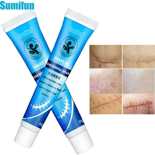 Sumifun 1pcs Skin Repair Ointment Scars Cream Remove Old Scar Fade Acne Stretch Marks Healing Burns Cuts Skin Care Products 20g