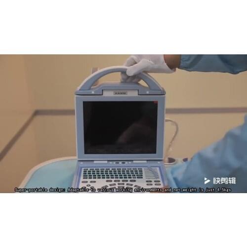 Digital vet veterinary color doppler ultrasound price