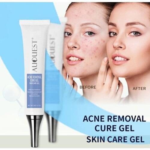 Acne Removal Cure Gel Scar Marks Acne Treatment Repair Cream Comedone Pimple Cleaning Blackhead Remover Skin Care