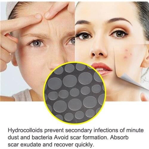 108pcs Skin Tag Remover Warts Remover Patch Wart Treatment Cream Herbal Extract Foot Corn Plaster Acne Warts Sticker