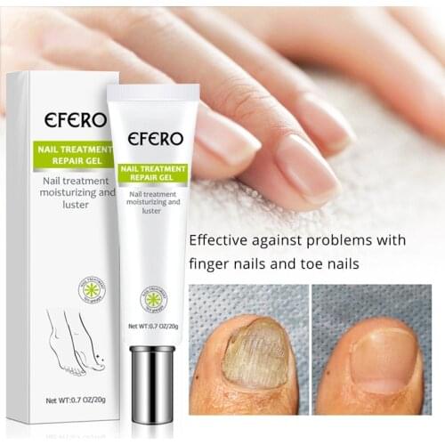 EFERO Fungal Nail Treatment Serum Anti Infection Onychomycosis Nail Fungus Removal Gel Nail Repair Nourish Essence Gel Nail Care