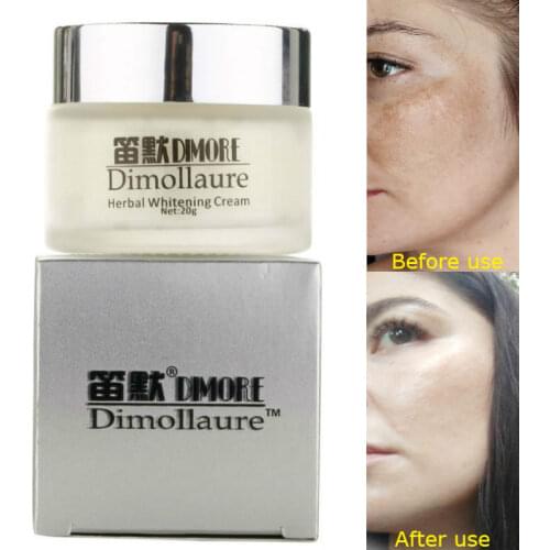 Dimollaure Whitening Freckle Cream Kojic Acid Cream Retinol Cream Melasma Remove Dark Spots Pigment Melanin Face Brightening