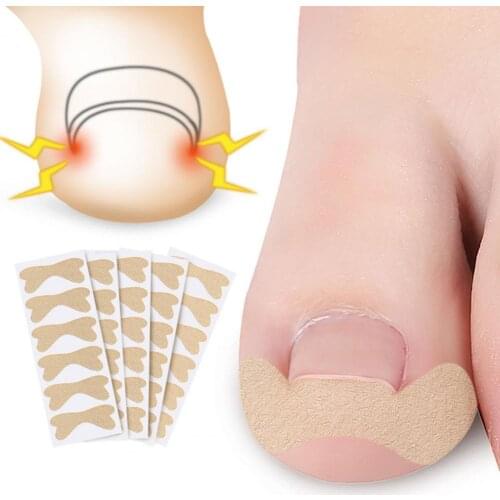 24/30/36/48/60Pcs Nail Art Ingrown Correction Sticker Foot Care Pedicure Tool Fixer Paronychia Recover Toenail Elastic Patch Cor