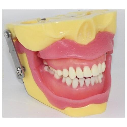 Tooth extraction practice model anesthesia tooth demonstration dental model dental teaching aids morphology tooth