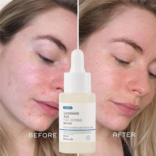 DEleventh Serums With Acids For The Face China