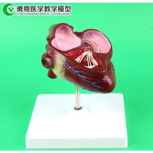 Free Shipping 1:1 Life Sized Pathological Anatomy Dog Heart Enlargement Heartworm Demonstration Model