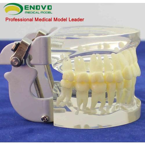 Adult standard dental model of standard dental model