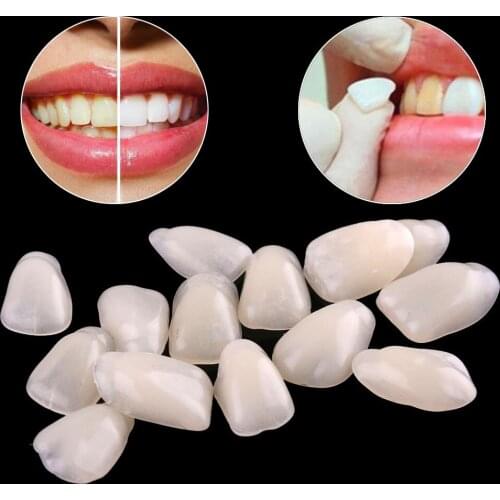 70PCS/Bag Beige Ultra-Thin Dental Films Resin Porcelain Teeth Veneers Upper Anterior Tooth Whitening Medical Health Care Tools