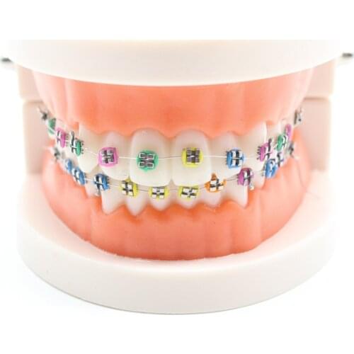 Dentistry Study Orthodontic Model Ortho Metal Bracket Arch Wire Ligature Tie For Dental Teaching 1 set