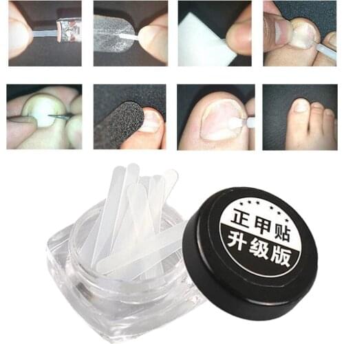 10 Pcs Ingrown Toenail Correction Stickers Paronychia Toenail Treatment Tape