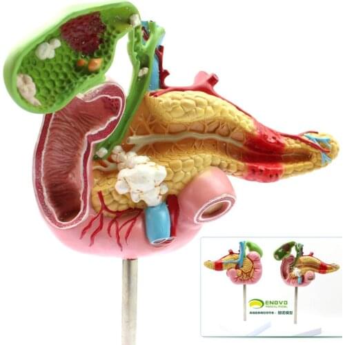 1:1 Life Size Human Pancreatic Duodenal Gallbladder Pathology Anatomy Model Surgical Digestive System Model Medical Supplies