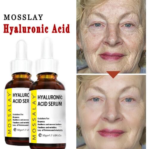 Mosslay Hyaluronic Face Serum
