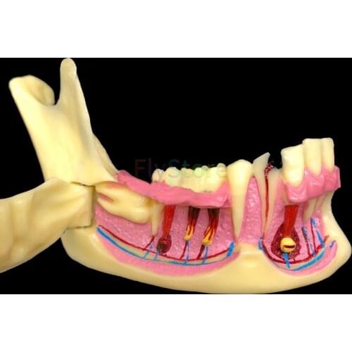 Dental Mandibular Teaching Model Teeth Demonstration Anatomical Study