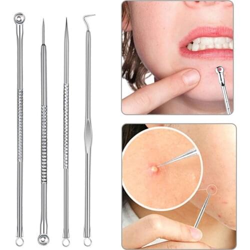 4Pcs/Set Acne Extractor Remover Tool Kit Blackhead Blemish Removers Pimple Needles Treatment Face Skin Care Tools