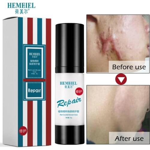 HEMEIEL Herb Essence Acne Scar Stretch Marks Remover Cream Skin Care Repair Face Cream Surgical Burn Scar Corrector Treatment