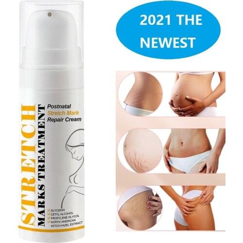 Remove Stretch Marks Body Lotion Cream Anti-Aging-Winkle Firming Body Natural Non-irritating Pregnancy Scars Repair Massage