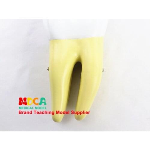 Human molar model dental display teaching model of dentistry demonstration MYC007