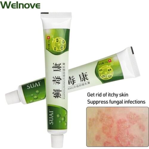 20g Treatment Acne Bedsore Dermatitis Psoriasis Cream Eczematoid Eczema Beriberi Ointment Anti Itch Medical Plaster Skin Care