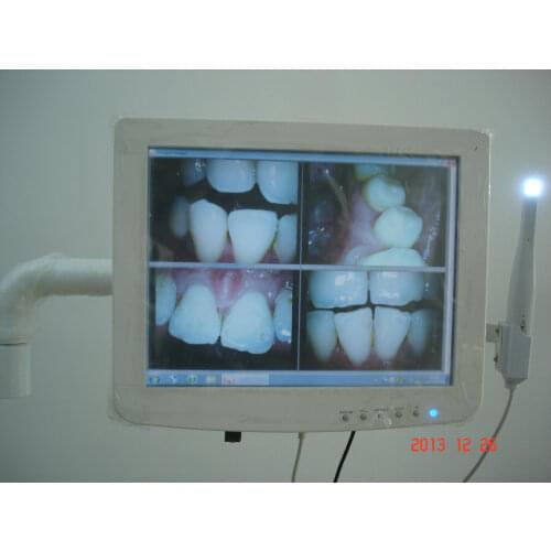 High Quality Dental Touch screen capacitive monitor with intraoral camera built in Intel/Windows10