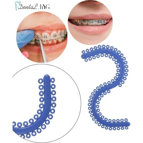 1Pc Dental Elastic Separators Orthodontic Material S shape Oral Separator Ligature Ties Blue Color Circle Rubber Ring