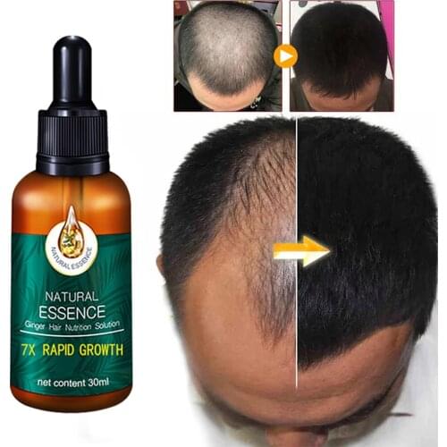 30ml Ginger Germinal Serum Essence Oil Loss Treatement Growth Hair Anti Hair Loss Prevention Alopecia Damaged Liquid Hair Repair