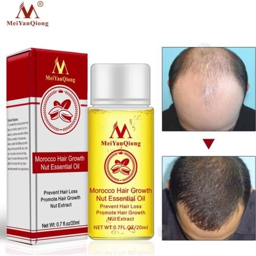 Fast Powerful Hair Growth Essence Hair Loss Products Essential Oil Liquid Treatment Preventing Hair Loss Hair Care Products 20ml