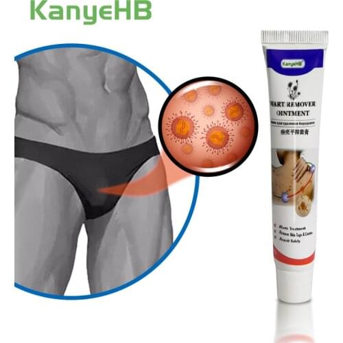 New Arrivals Wart Removal Ointment Genitals Wart Treatment Cream Neck Skin Tag Armpit Flat Wart Feet Corns Medical Cream G001