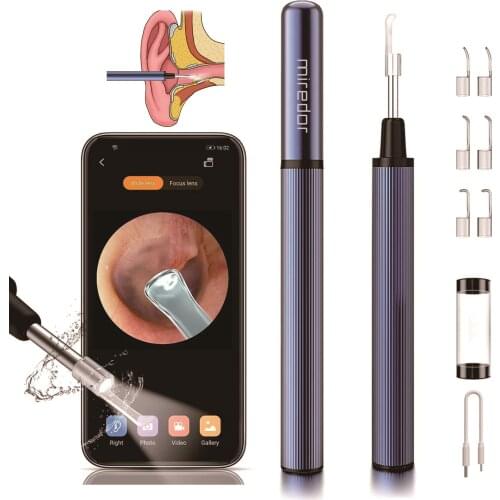 Miredor Smart Visual Ear Cleaner Otoscope With App-enable Camera 3.5mm1080P,Wifi Endoscope Earwax Removal Kits Adults&Children