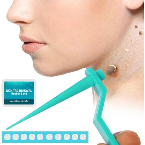 Skin Tag Removal Kit Skin Mole Wart Remover Skin Tag Equipment Kill Mole Tag Effective Wart Skin Care Tool Treatment P2Q5