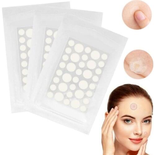 Acne Pimple Patch Stickers Acne Pimple Remover Tool Absorb Pus And Oil Acne Patch Face Skin Care As Protective Cover 36 Patches