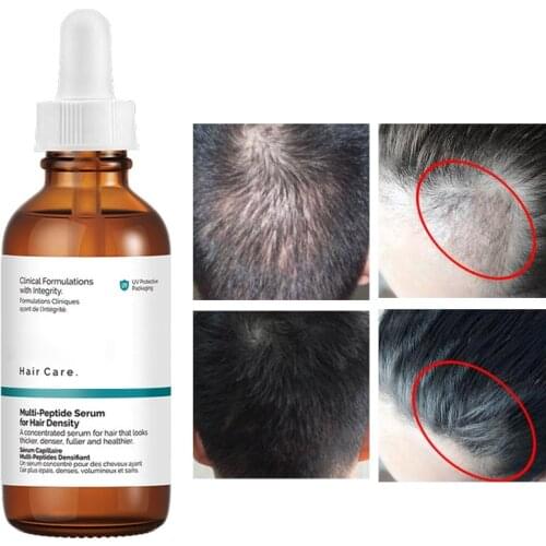 Serum Hair Care Ordinary 60ml Multi-Peptide Serum For Hair Density Hair Growth Strength Polypeptide Scalp